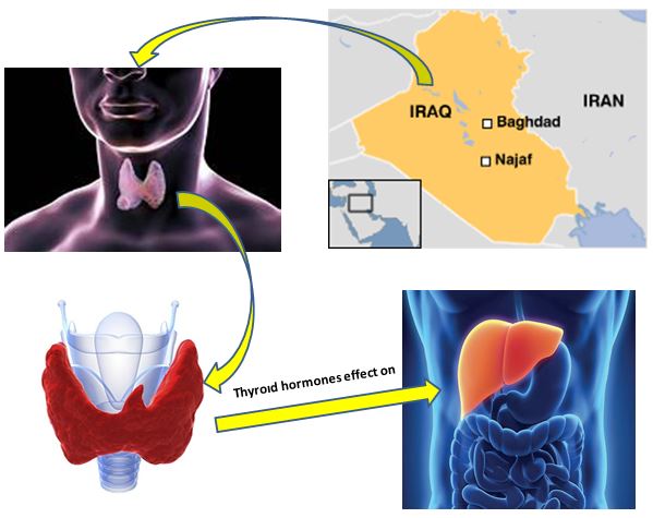 Study of thyroid hormones effect on biochemical parameters of liver function in Iraqi patients 