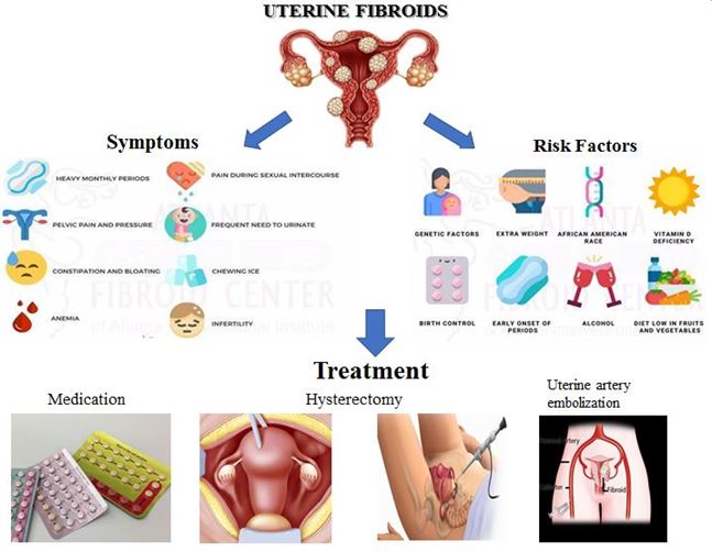 A study on uterine fibroids effective treatment and associated risks factors in the tertiary care teaching hospital 