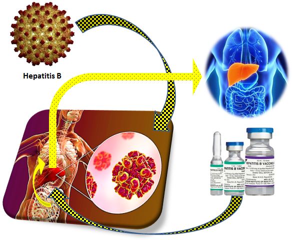 Prevalence of hepatitis B in HIV-positive patients in Zabol 