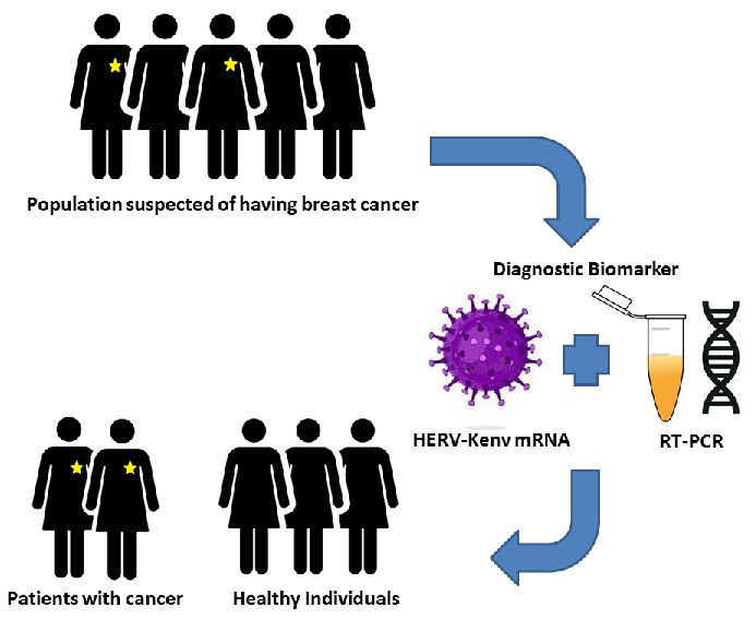 Association between Human Endogenous Retrovirus K gene expression and breast cancer 