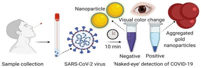 Current trends and new methods of detection of SARS-CoV-2 infection 
