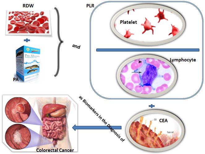 Combined Diagnostic Efficacy of Red Blood Cell Distribution Width (RDW), Prealbumin (PA), Platelet-to-Lymphocyte Ratio (PLR), and Carcinoembryonic Antigen (CEA) as Biomarkers in the Diagnosis of Colorectal Cancer 